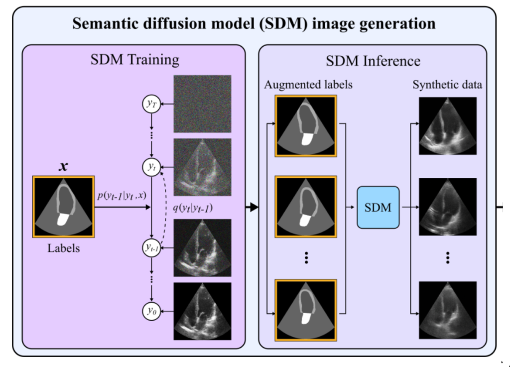 The semantic diffusion model.
